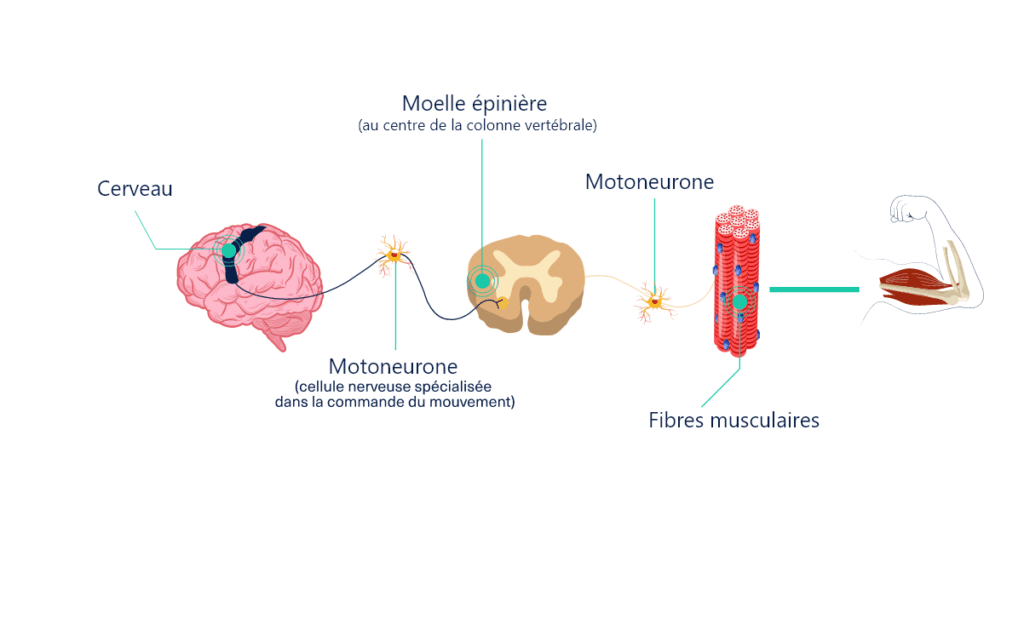 Spasticité La spasticité : Définition, causes et symptômes